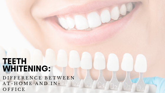 Teeth whitening display with a woman smiling behind